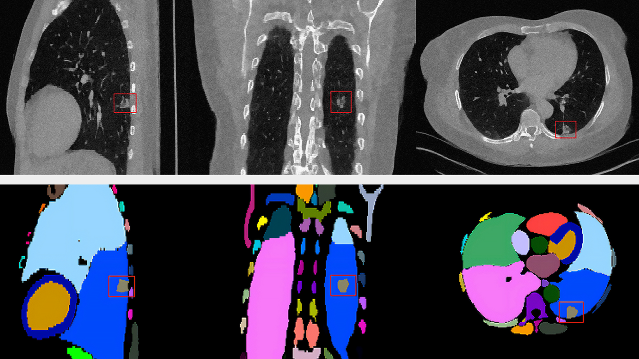 Expanding Horizons: New Generative AI for CT Images and VISTA-2D for Cell Imaging