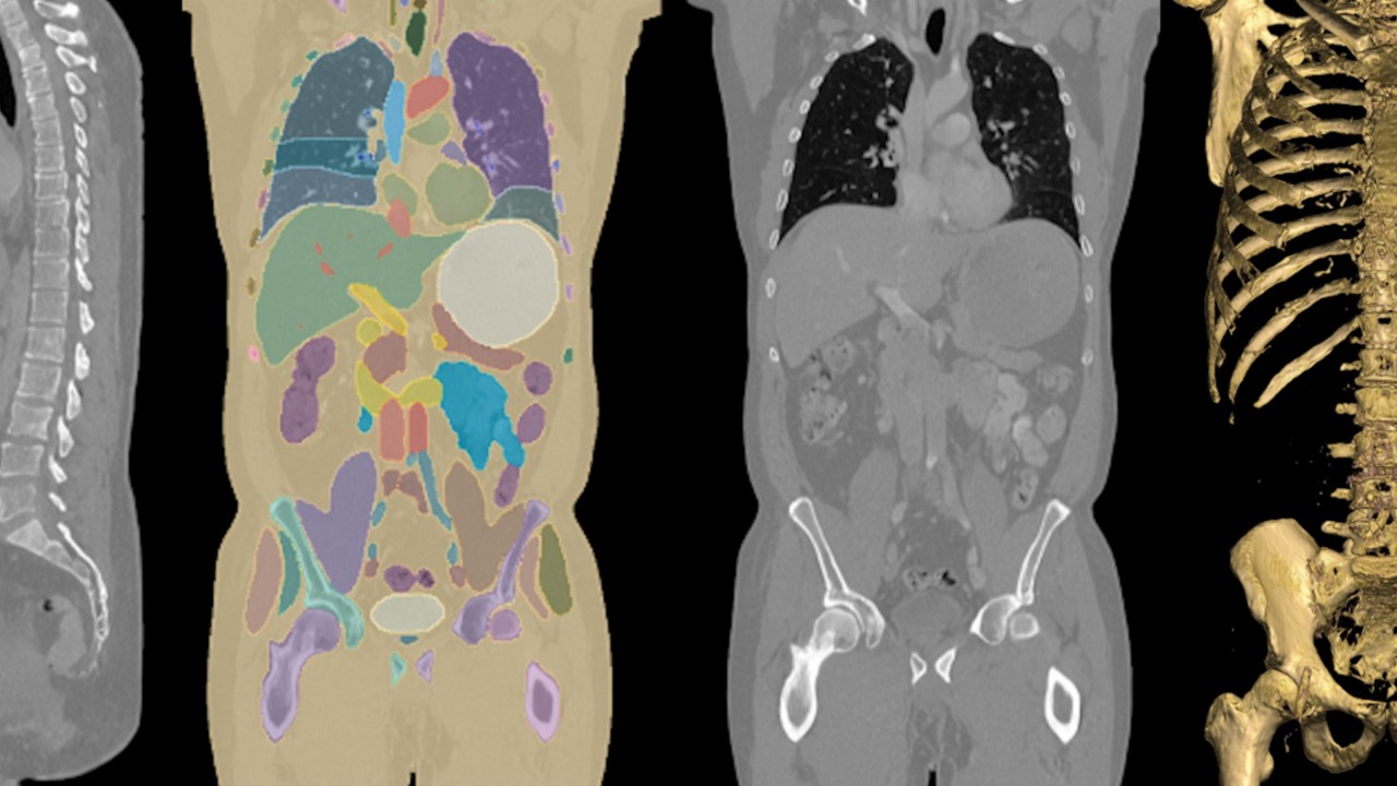 借助开放源代码工具和高级模型优化医疗 AI 训练
