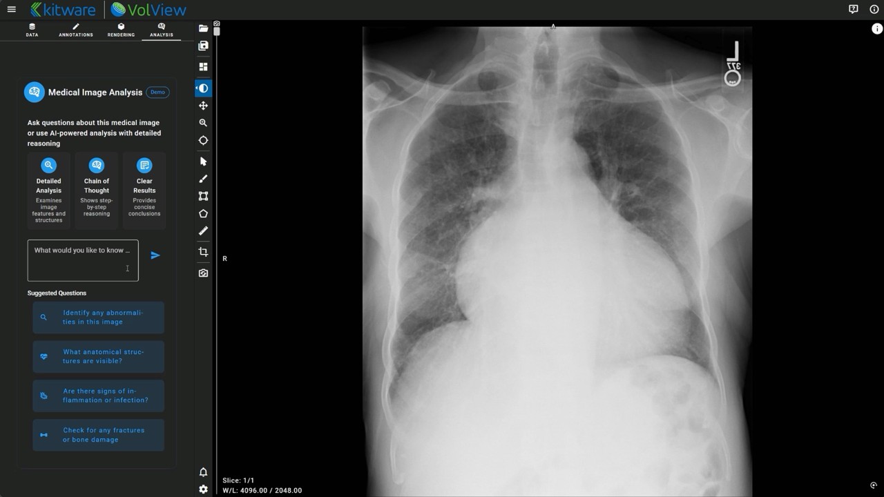 将医学图像分析与用于放射科智能体的对话式 AI 相结合