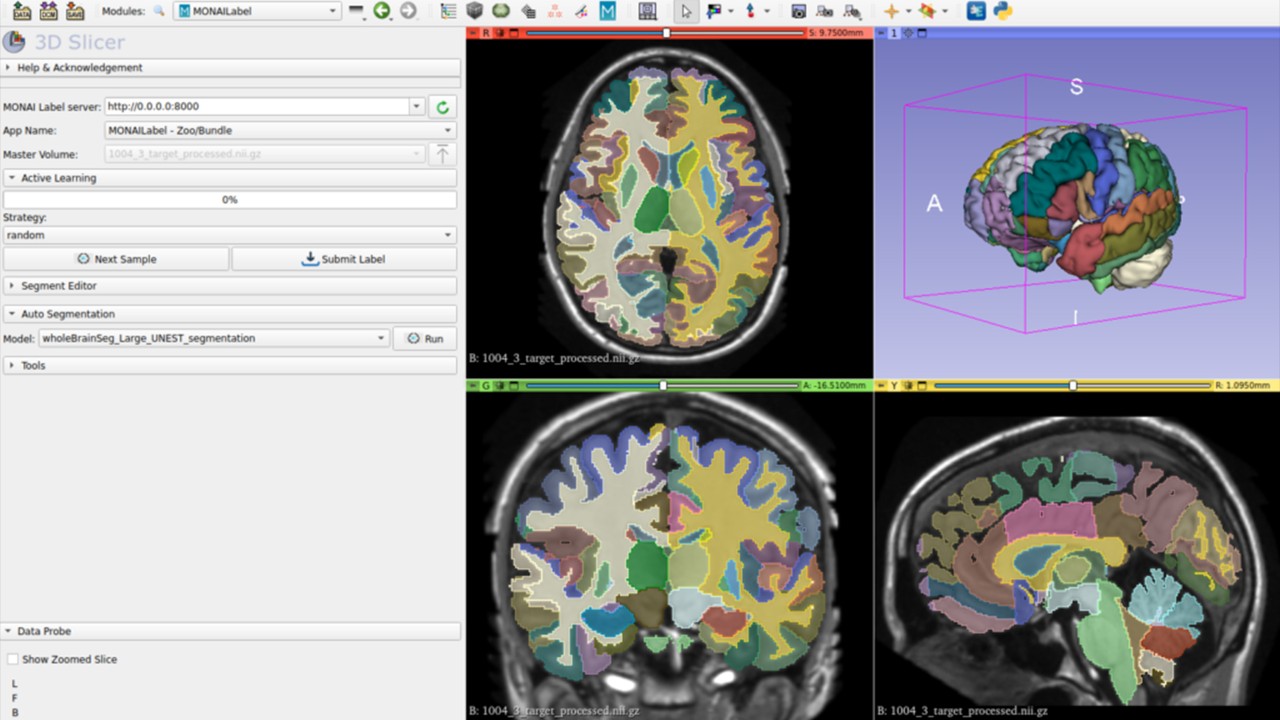 借助 AI 赋能的分析和推理，变革医疗影像