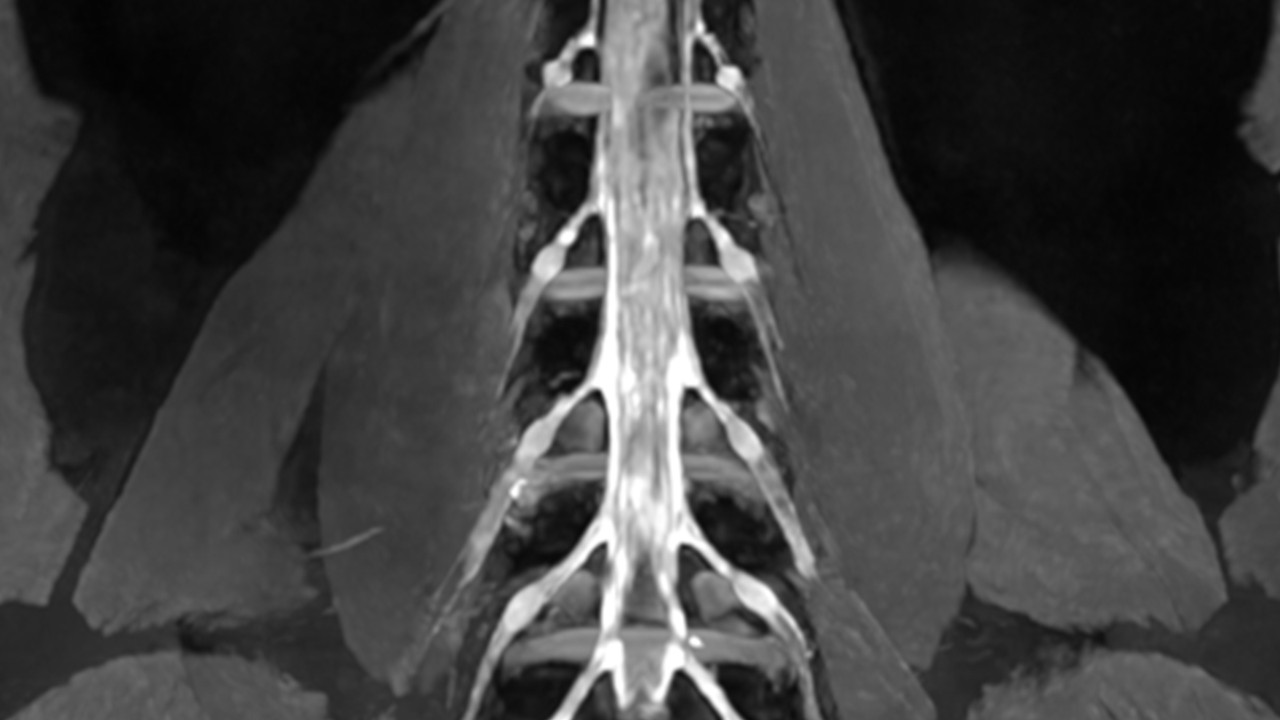 借助 NVIDIA AI 加速医疗影像重建