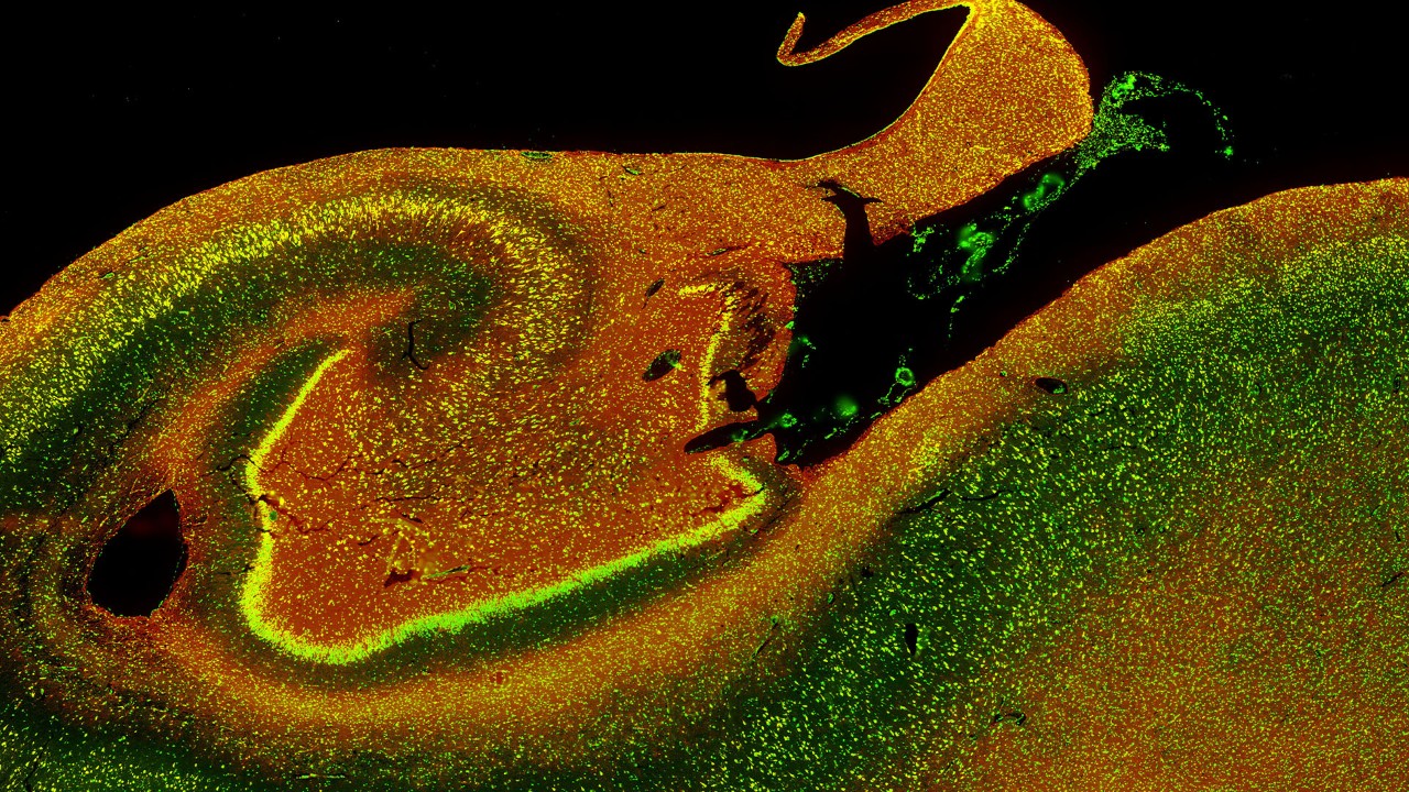 空间转录组学分析